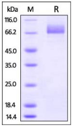 Influenza , His Tag on SDS-PAGE under reducing (R) condition. The gel was stained overnight with Coomassie Blue. The purity of the protein is greater than 95%.